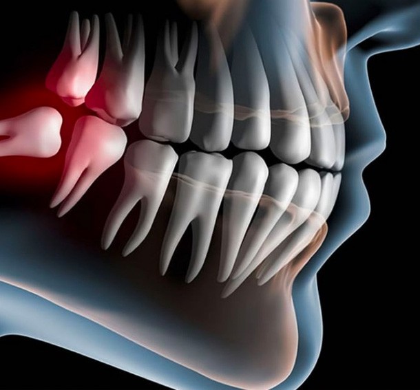 Cirugía Oral en Clínica Dental Otero